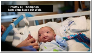 Baby kommt ohne Nase zur Welt – und begeistert die Facebook-Community