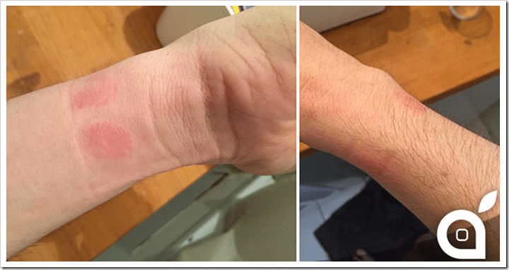 Apple-Watch