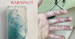 Verletzungen durch iPhone Hülle?