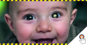 Kan een foto flitslicht levens redden? (Retinoblastoom Test)