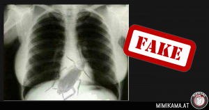 De kakkerlakken op de röntgenfoto: Fake!