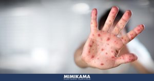 Falschmeldung: „BGH-Urteil bestätigt: Masern-Viren existieren nicht“