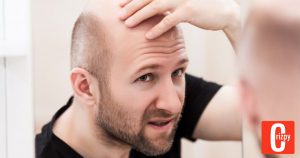 Neue Studie: Zu viel Arbeit begünstigt Haarausfall bei Männern
