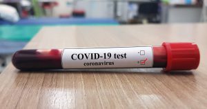 Fact check – “The corona virus test is a pseudoscientific roulette”