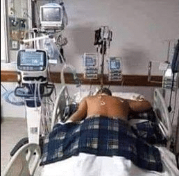 Bilder von angeblichen COVID-19 Patienten (Faktencheck) – mimikama.org Bild 1