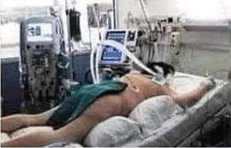 Bilder von angeblichen COVID-19 Patienten (Faktencheck) – mimikama.org Bild 3