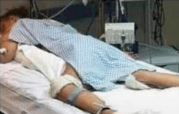 Bilder von angeblichen COVID-19 Patienten (Faktencheck) – mimikama.org Bild 5