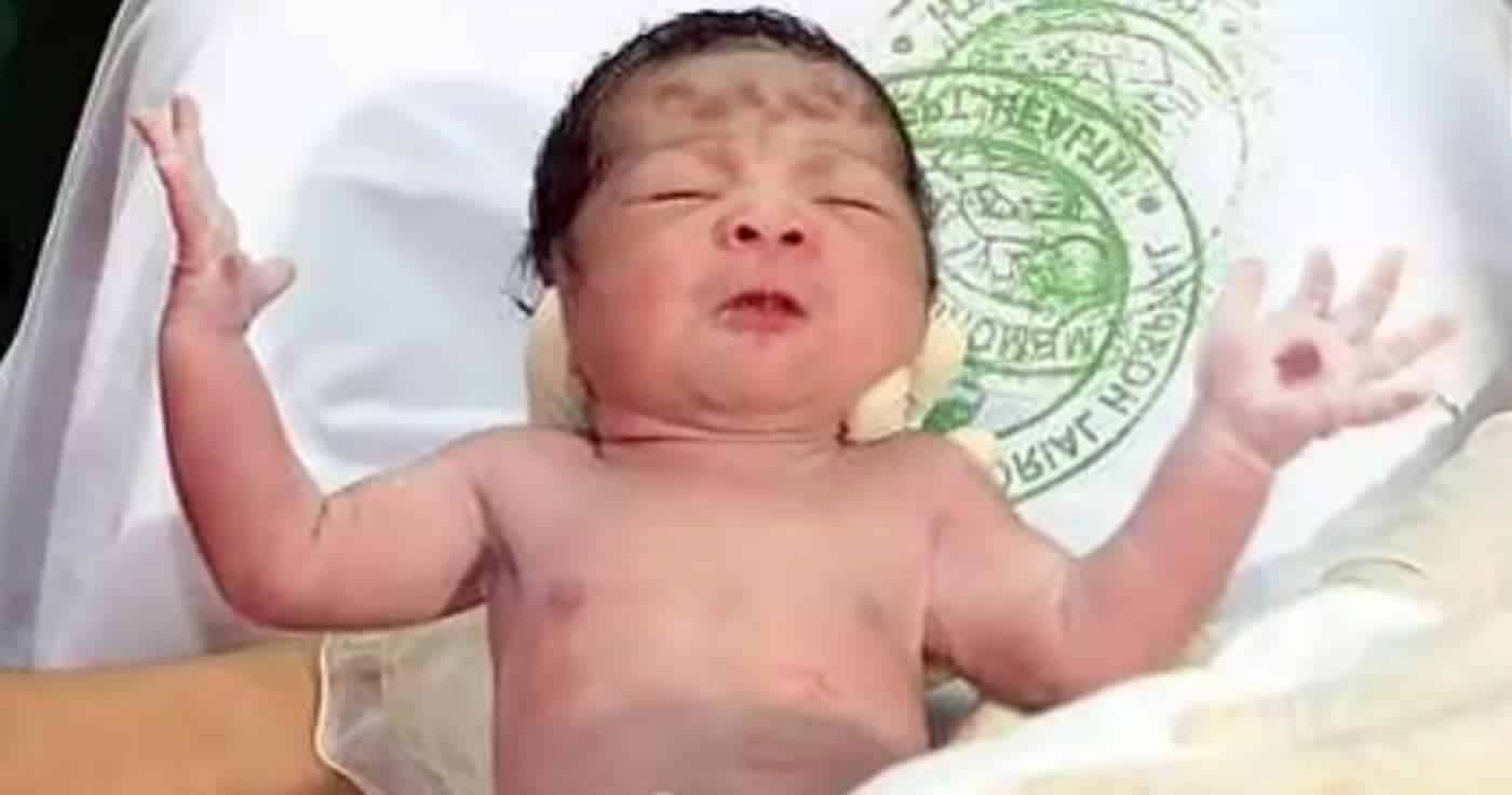 Fake: Baby mit Stigmata von Jesus Christus geboren