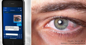 This eye scanning app is intended to detect corona disease