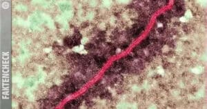 Nipahvirus in Indien: Was steckt hinter dem tödlichen Ausbruch?